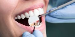 Zubní prohlídka u dospělého pojištěnce